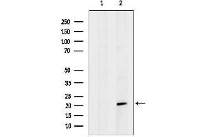 Western blot analysis of lysates from 3, using Hsp Antibody. (HspB4 (Internal Region) antibody)