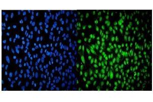 IF analysis of USP16 using anti-USP16 antibody (ABIN7602640). (USP16 antibody  (AA 9-823))