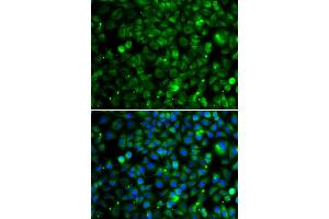 Immunofluorescence analysis of MCF-7 cells using TMLHE antibody (ABIN4905441).