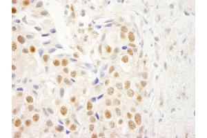 Immunohistochemistry (IHC) image for anti-Nuclear Receptor Binding Factor 2 (NRBF2) (AA 125-175) antibody (ABIN7448699) (NRBF2 antibody  (AA 125-175))