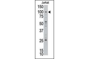 Western blot analysis of anti-MLLT10 Pab (ABIN390125 and ABIN2840631) in Jurkat cell line lysate. (MLLT10 antibody  (C-Term))