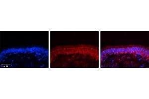 Rabbit Anti-C14orf166 Antibody     Formalin Fixed Paraffin Embedded Tissue: Human Bronchial Epithelial Tissue  Observed Staining: Cytoplasmic  Primary Antibody Concentration: 1:100  Secondary Antibody: Donkey anti-Rabbit-Cy3  Secondary Antibody Concentration: 1:200  Magnification: 20X  Exposure Time: 0. (C14orf166 antibody  (N-Term))