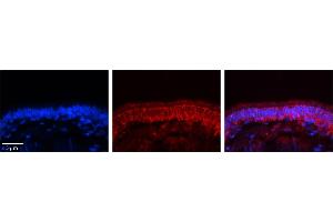 Rabbit Anti-C14orf166 Antibody     Formalin Fixed Paraffin Embedded Tissue: Human Bronchial Epithelial Tissue  Observed Staining: Cytoplasmic  Primary Antibody Concentration: 1:100  Secondary Antibody: Donkey anti-Rabbit-Cy3  Secondary Antibody Concentration: 1:200  Magnification: 20X  Exposure Time: 0. (C14orf166 antibody  (N-Term))