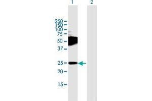 Western Blot analysis of TMEM123 expression in transfected 293T cell line by TMEM123 MaxPab polyclonal antibody.