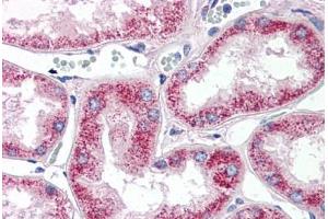 Human Kidney (formalin-fixed, paraffin-embedded) stained with MMP2 antibody ABIN337360 at 10 ug/ml followed by biotinylated anti-mouse IgG secondary antibody ABIN481714, alkaline phosphatase-streptavidin and chromogen. (MMP2 antibody  (AA 468-483))