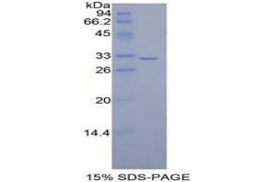SDS-PAGE analysis of Mouse MAP2K7 Protein. (MAP2K7 Protein)