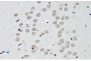 Immunohistochemistry of paraffin-embedded Mouse brain using CTCF Polyclonal Antibody at dilution of 1:200 (40x lens). (CTCF antibody)