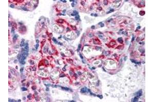 Immunohistochemical analysis of paraffin-embedded human placenta tissue using VCAM1 monoclonal antobody, clone 6G9  with DAB staining.