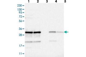 Western blot analysis of Lane 1: RT-4, Lane 2: U-251 MG, Lane 3: Human Plasma, Lane 4: Liver, Lane 5: Tonsil with CCDC43 polyclonal antibody  at 1:250-1:500 dilution.
