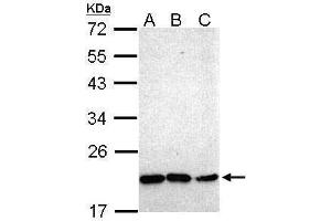 WB Image Sample (30 ug of whole cell lysate) A: Hep G2 , B: Molt-4 , C: Raji 12% SDS PAGE antibody diluted at 1:1000 (NKX2-8 antibody)
