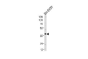 Western blot analysis of lysate from SH-SY5Y cell line, using SERPINI1 Antibody (N-term) (ABIN654346 and ABIN2844114).