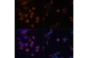 Immunofluorescence analysis of NIH/3T3 cells using MAP1LC3B antibody (ABIN6291775) at dilution of 1:100.