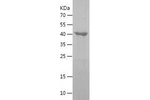 Western Blotting (WB) image for GTP Binding Protein 3 (Mitochondrial) (GTPBP3) (AA 282-492) protein (His-IF2DI Tag) (ABIN7283271) (GTPBP3 Protein (AA 282-492) (His-IF2DI Tag))