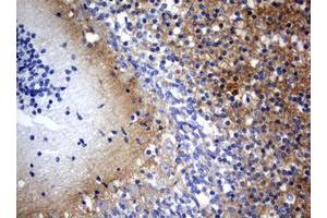 Image no. 1 for anti-Visinin-Like 1 (VSNL1) (AA 2-191) antibody (ABIN1491123) (VSNL1 antibody  (AA 2-191))