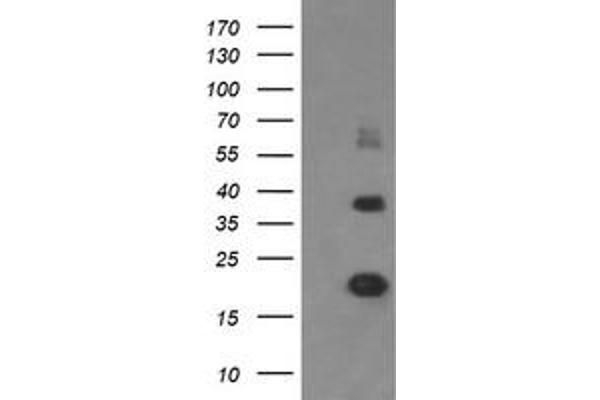 MCTS1 antibody  (AA 1-181)