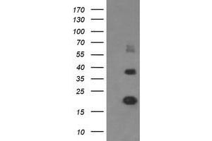 Image no. 5 for anti-Malignant T Cell Amplified Sequence 1 (MCTS1) (AA 1-181) antibody (ABIN1490598) (MCTS1 antibody  (AA 1-181))