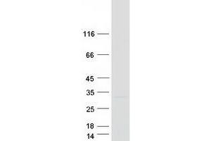 Validation with Western Blot (CSN2 Protein (Myc-DYKDDDDK Tag))