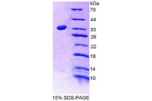 SDS-PAGE (SDS) image for ATG7 Autophagy Related 7 (ATG7) (AA 249-517) protein (His tag) (ABIN2127162) (ATG7 Protein (AA 249-517) (His tag))