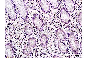 Immunohistochemistry (IHC) image for anti-Cancer/testis Antigen 2 (CTAG2) (AA 121-210) antibody (ABIN721135) (CTAG2 antibody  (AA 121-210))
