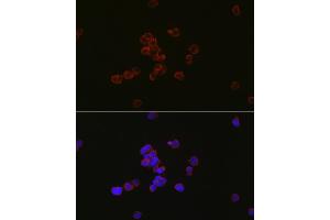 Immunofluorescence analysis of Jurkat cells using MYL12B antibody (ABIN7268760) at dilution of 1:100. (MYL12B antibody)