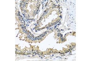Immunohistochemistry of paraffin-embedded human prostate using CST1 antibody (ABIN5975714) at dilution of 1/100 (40x lens). (CST1 antibody)