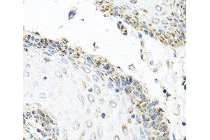 Immunohistochemistry of paraffin-embedded Human esophagus using GNRH2 Polyclonal Antibody at dilution of 1:100 (40x lens). (GnRH2 antibody)