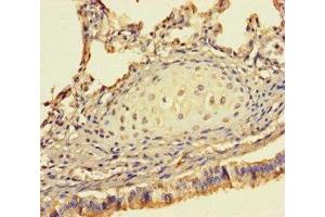 Immunohistochemistry of paraffin-embedded human lung tissue using ABIN7142194 at dilution of 1:100 (26S Proteasome Complex Subunit SEM1 (SEM1) (AA 1-70) antibody)