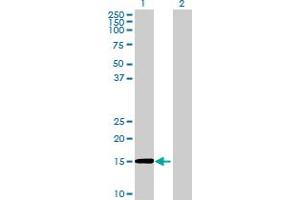 Western Blot analysis of RAG1AP1 expression in transfected 293T cell line ( H00055974-T01 ) by RAG1AP1 MaxPab polyclonal antibody. (SLC50A1 antibody  (AA 1-167))