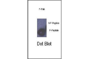 Dot blot analysis of anti-Phospho-Rb- Antibody (ABIN389644 and ABIN2839636) on nitrocellulose membrane. (Retinoblastoma 1 antibody  (pSer780))