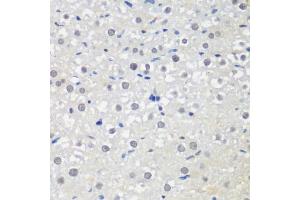 Immunohistochemistry of paraffin-embedded rat liver using CTCF antibody (ABIN6130043, ABIN6139180, ABIN6139182 and ABIN6217207) at dilution of 1:200 (40x lens). (CTCF antibody  (AA 1-260))