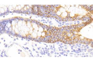 Detection of CK13 in Human Colon Tissue using Polyclonal Antibody to Cytokeratin 13 (CK13)