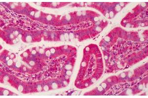 Human Small Intestine: Formalin-Fixed, Paraffin-Embedded (FFPE) (Forkhead Box K2 antibody  (AA 491-540))