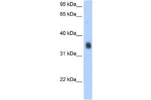 WB Suggested Antibody Titration:  2. (SLC35F2 antibody  (N-Term))