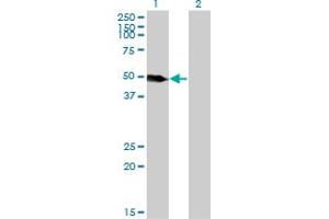Western Blot analysis of LSP1 expression in transfected 293T cell line by LSP1 monoclonal antibody (M07), clone 1C4.