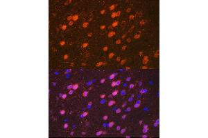 Immunofluorescence analysis of mouse brain cells using TBR1 Rabbit mAb (ABIN7270703) at dilution of 1:100 (40x lens). (TBR1 antibody)