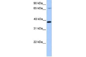 HMBS antibody used at 1 ug/ml to detect target protein. (HMBS antibody  (N-Term))