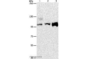 Western blot analysis of A431, 293T and hela cell, using ASCC2 Polyclonal Antibody at dilution of 1:500 (ASCC2 antibody)