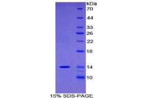SDS-PAGE (SDS) image for Family with Sequence Similarity 19 (Chemokine (C-C Motif)-Like), Member A4 (FAM19A4) (AA 46-139) protein (His tag) (ABIN1880041)