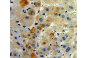 Used in DAB staining on fromalin fixed paraffin-embedded Liver tissue (FAS antibody  (AA 22-169))