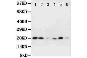Western Blotting (WB) image for anti-Heat Shock 27kDa Protein 2 (HSPB2) (AA 102-118), (Middle Region) antibody (ABIN3044185) (HSPB2 antibody  (Middle Region))