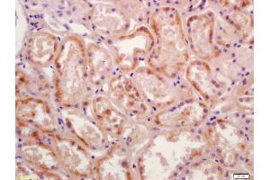 Formalin-fixed and paraffin embedded human kidney labeled with Anti-Phospho-SGK1 (Thr256) Polyclonal Antibody, Unconjugated (ABIN745718) at 1:200 followed by conjugation to the secondary antibody and DAB staining (SGK1 antibody  (pThr256))