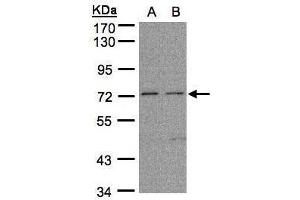 WB Image Sample (30μg whole cell lysate) A: H1299 B: HeLa S3, 7. (FLRT1 antibody)
