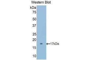 Western Blotting (WB) image for anti-Cubilin (Intrinsic Factor-Cobalamin Receptor) (CUBN) (AA 3157-3274) antibody (ABIN1175677) (CUBN antibody  (AA 3157-3274))