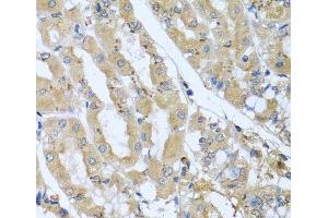 Immunohistochemistry of paraffin-embedded Human stomach using STX7 Polyclonal Antibody at dilution of 1:100 (40x lens).