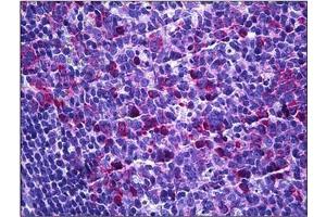 Human Tonsil: Formalin-Fixed, Paraffin-Embedded (FFPE) (EIF3D antibody)