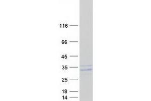 Western Blotting (WB) image for Progestagen-Associated Endometrial Protein (PAEP) (Transcript Variant 2) protein (Myc-DYKDDDDK Tag) (ABIN2722039)