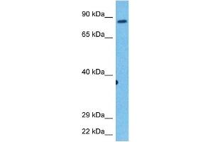 Host:  Rabbit  Target Name:  KIF2C  Sample Tissue:  Human Stomach Tumor  Antibody Dilution:  1ug/ml