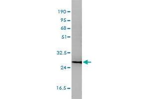 CD58 monoclonal antibody (M01), clone 2D11-B10 Western Blot analysis of CD58 expression in Jurkat . (CD58 antibody  (AA 1-240))