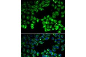 Immunofluorescence analysis of U2OS cells using NEIL1 Polyclonal Antibody (NEIL1 antibody)