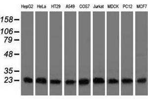Western blot analysis of extracts (35 µg) from 9 different cell lines by using anti-CLPP monoclonal antibody. (CLPP antibody)